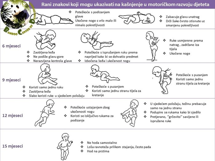 Rani znaci koji mogu ukazivati na kasnjenje u motoričkom razvoju deteta